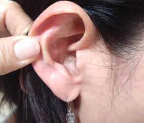 ー耳つぼダイエットで健康的に体重を減らす方法ー